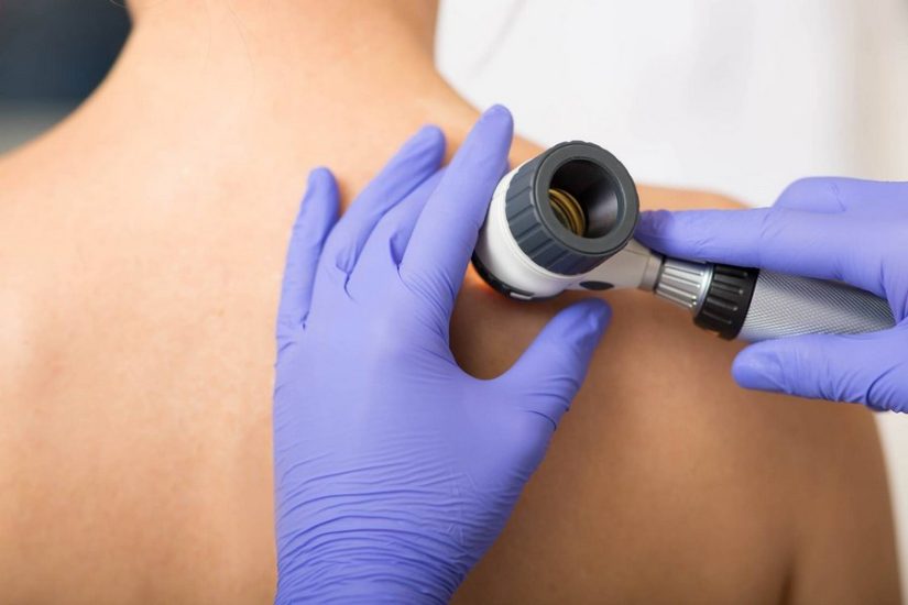 What to Expect During a Skin Cancer Screening Test